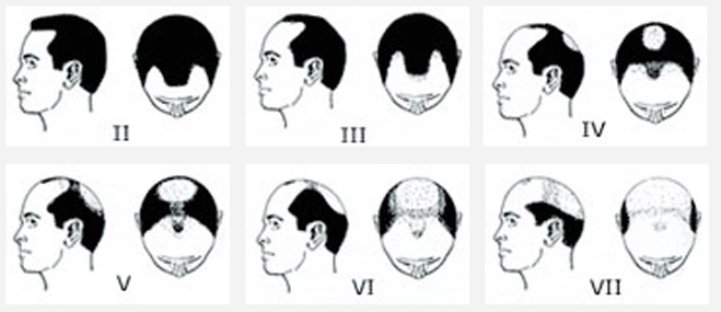 types002 types002